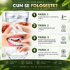 Set Fațete Dentare Cosmetice